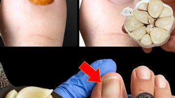 🌱 I Used Aloe Vera in My Hair for 7 Days and This Is What Happened